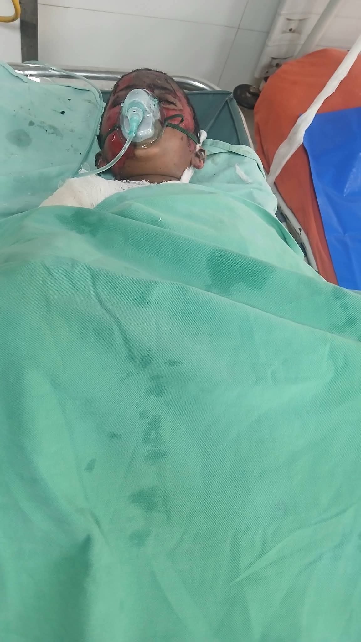 আগুনে পোড়া তাওহিদুল ইসলাম   এ পৃথিবীতে আর নেই