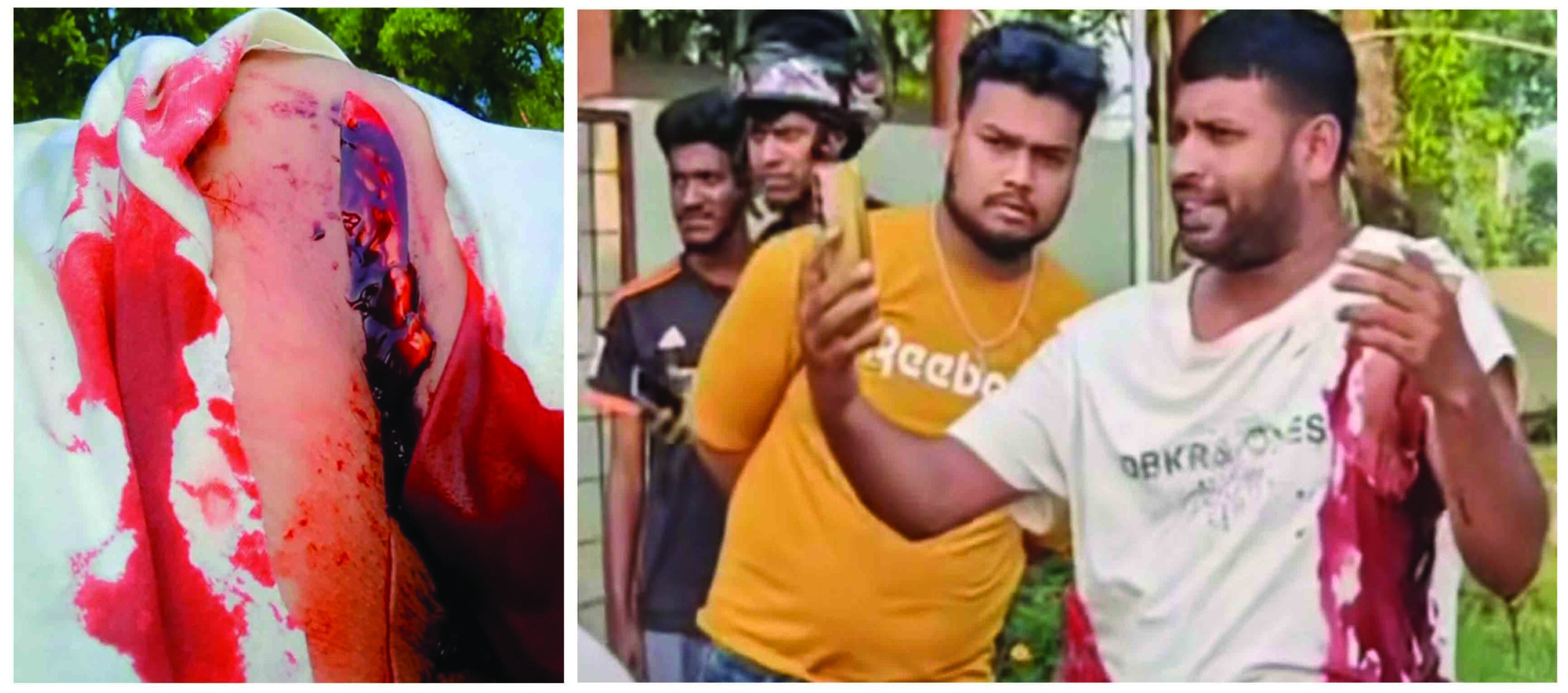 ঈশ্বরদীতে পাম্পে তেল নিতে গিয়ে দ্বন্দ্ব, যুবককে ছুরিকাঘাত