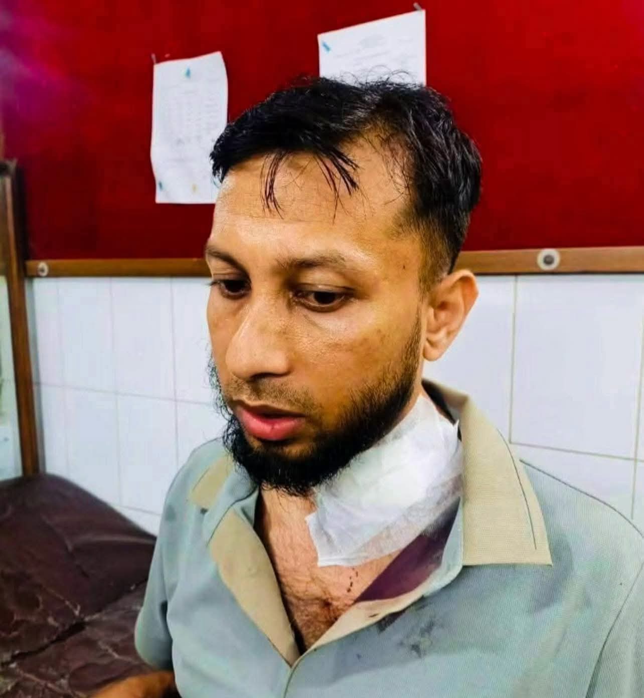 ছুটিতে নিজ এলাকায় গিয়ে ডাকাত দলের হামলায় আহত মুরাদনগরের এসিল্যান্ড